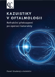 Kazuistiky v oftalmologii: Refrakční překvapení po operaci katarakty